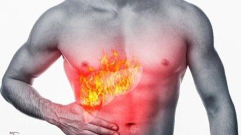 Dấu hiệu nhận biết gan bạn đang bị nóng